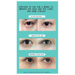 Load image into Gallery viewer, JUJY Pro iHero Eyes Care Massager | 24K Gold-Plated Eye Rejuvenation for Wrinkles, Puffiness &amp; Dark Circles JUJY